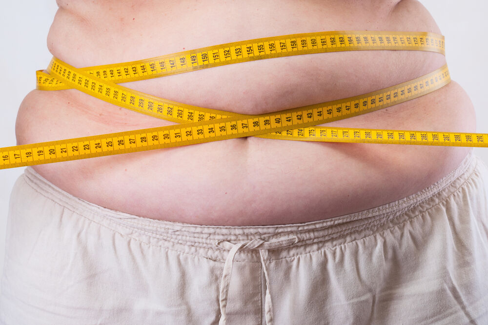 Gojaznost, Foto: Shutterstock