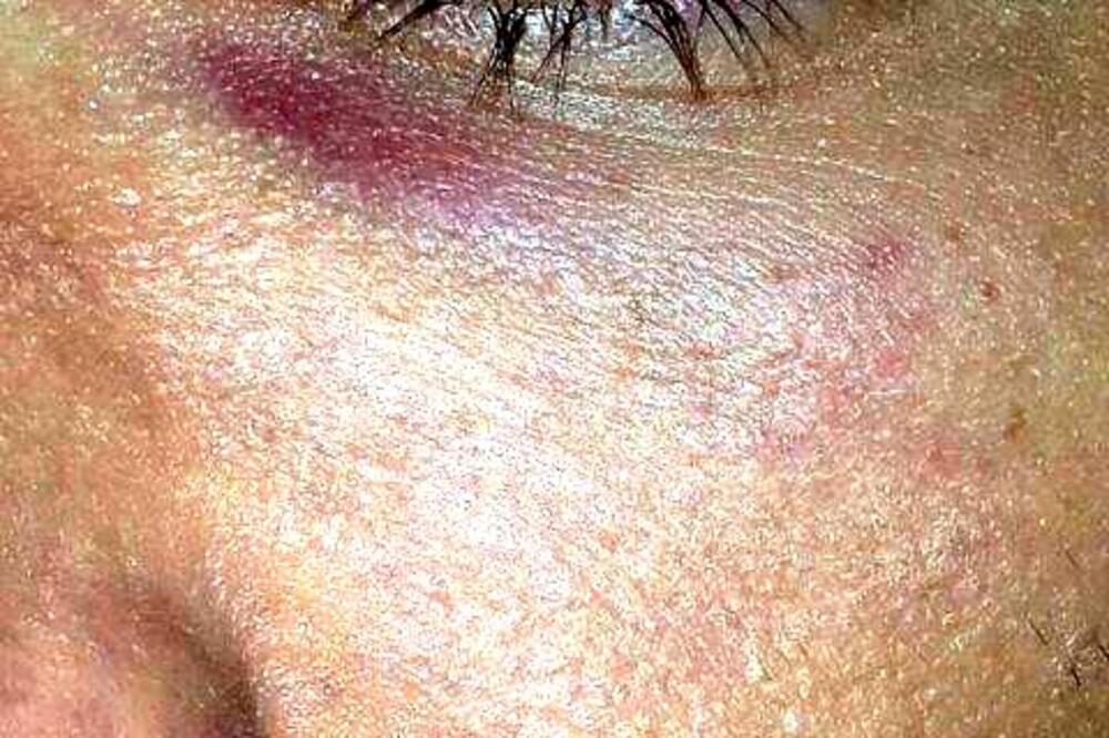 LGBT aktivista, Foto: LGBT Forum Progres