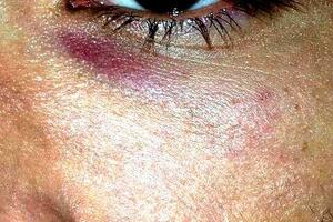 LGBT aktivista se protivi procesuiranju maloljetnika (14) koji ga...