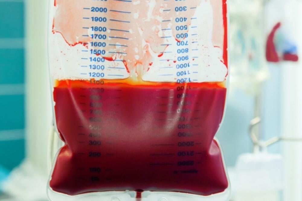 Transfuzija, Foto: Shutterstock