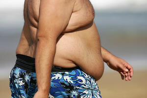 Znate li koliko godina života vam oduzima gojaznost?