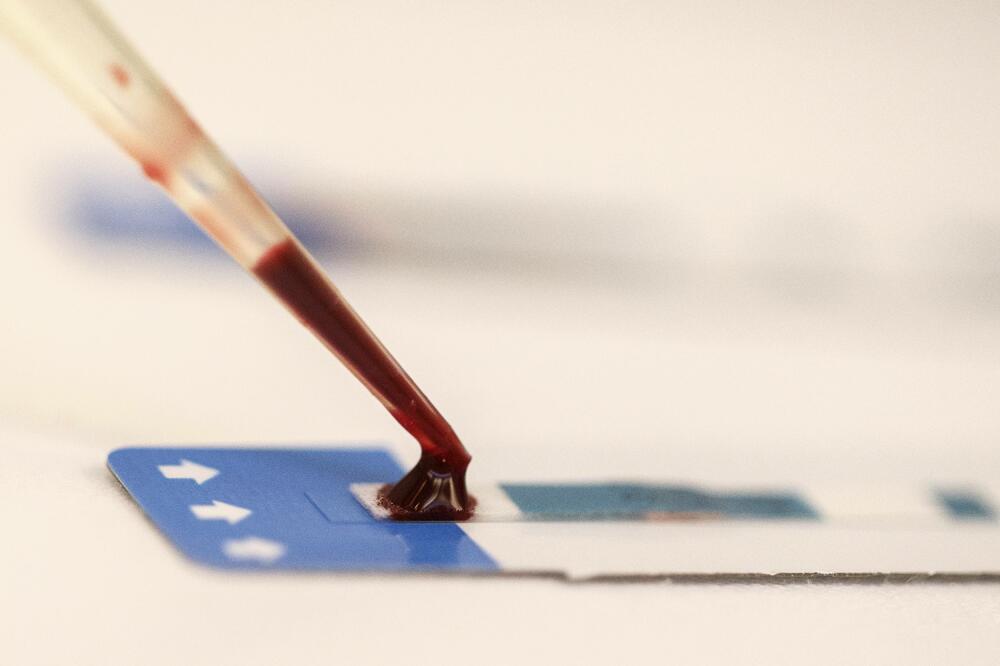 Analiza krvi, Foto: Reuters