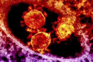 Od misterioznog virusa preminulo 348 osoba u Arabiji