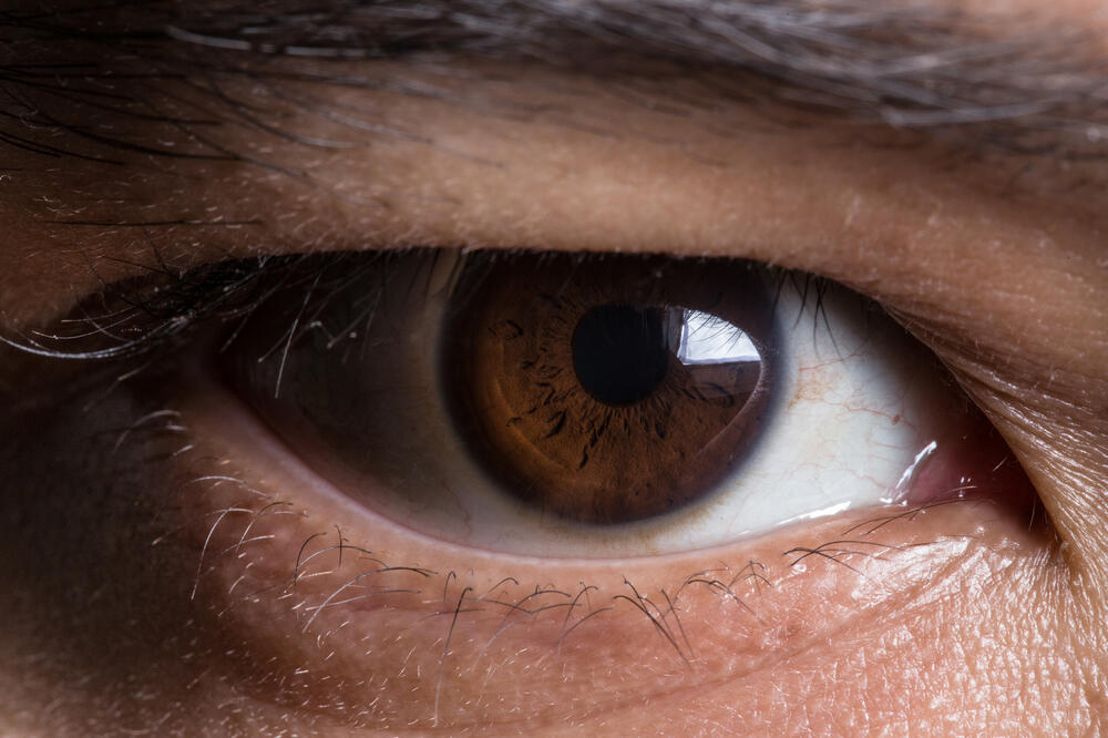oko, oči, Foto: Shutterstock