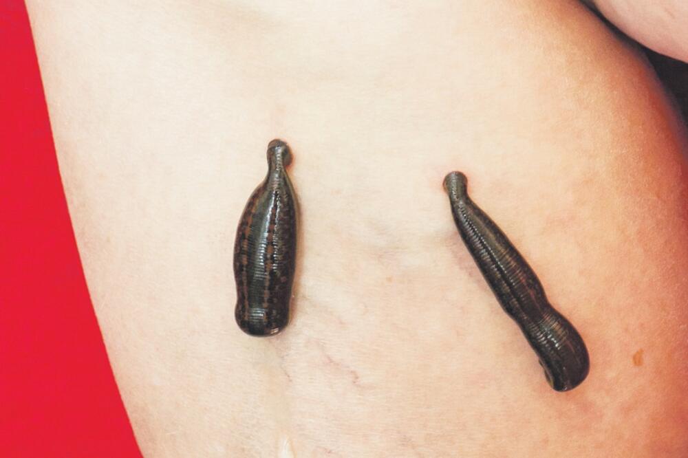 pijavice, Foto: Shutterstock.com