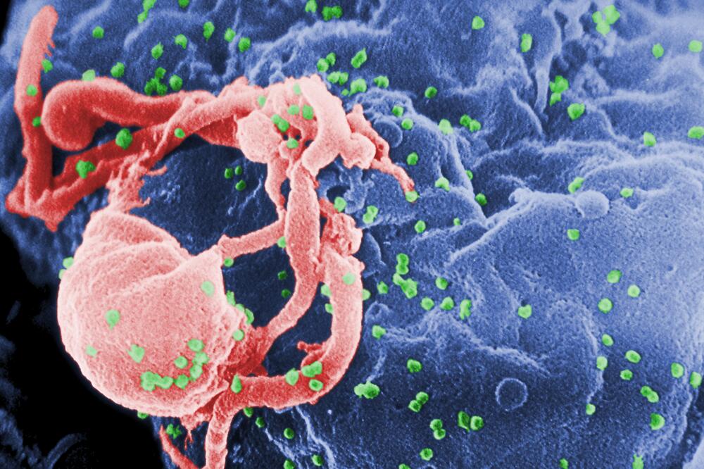 HIV, Foto: Wikipedia