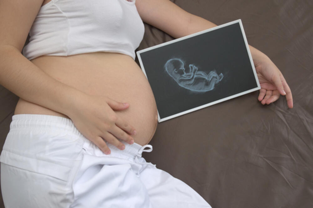 trudnica, Foto: Shuterstock