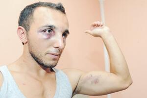 Izvještaj o prebijanju Moračanina: Policijske palice radile mimo...