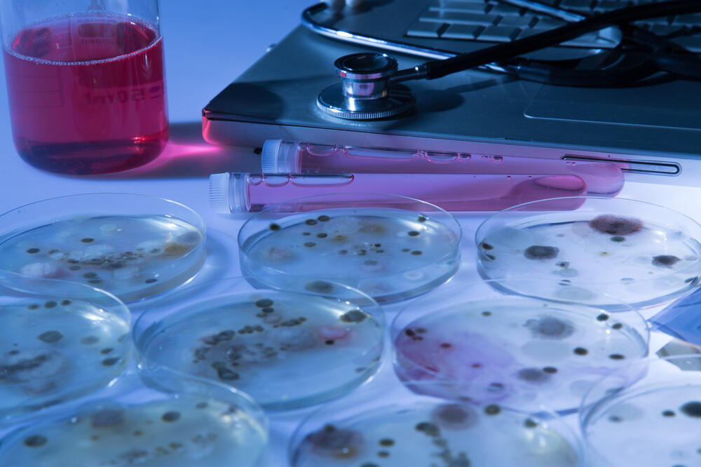 ebola, Foto: Shutterstock