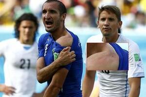 Luis Suares opet ujeda!?