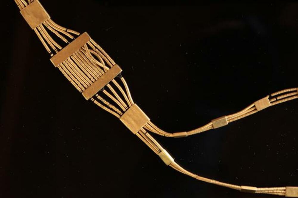 Zlatna ogrlica, Foto: Beta/AP