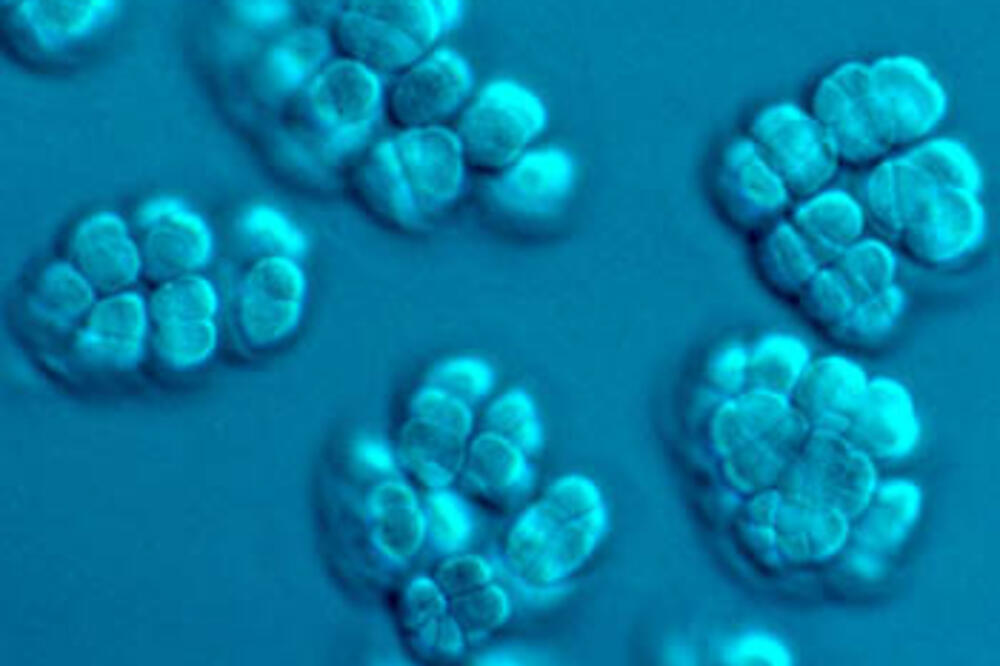 Methanosarcina, Foto: Microbewiki