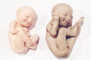 Revolucije 3D štampe: Isprintajte model svoje nerođene bebe