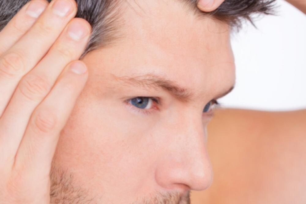 Muška kosa, Foto: Shutterstock