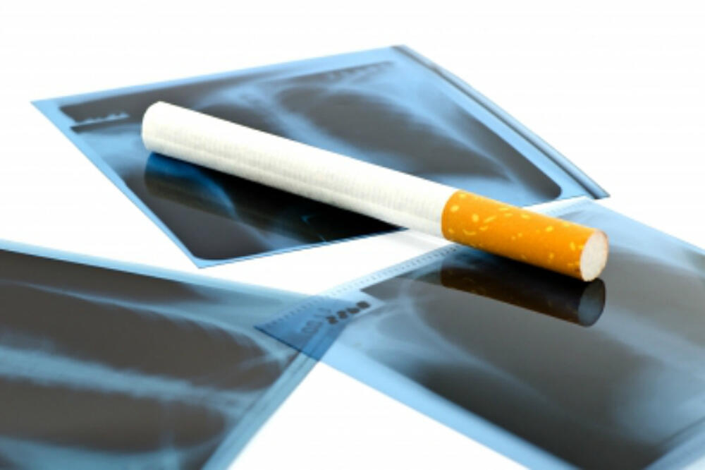 Elektronske cigarete, Foto: AP