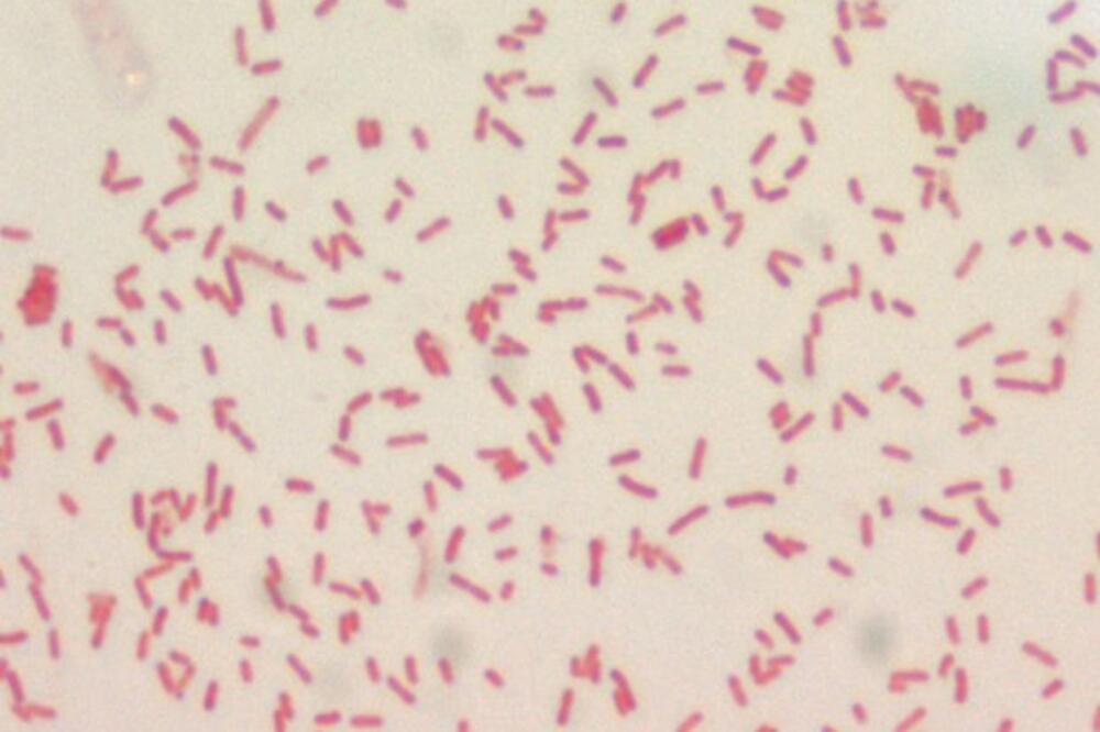 kuga, yersinia pestis, Foto: Doh.sd.gov