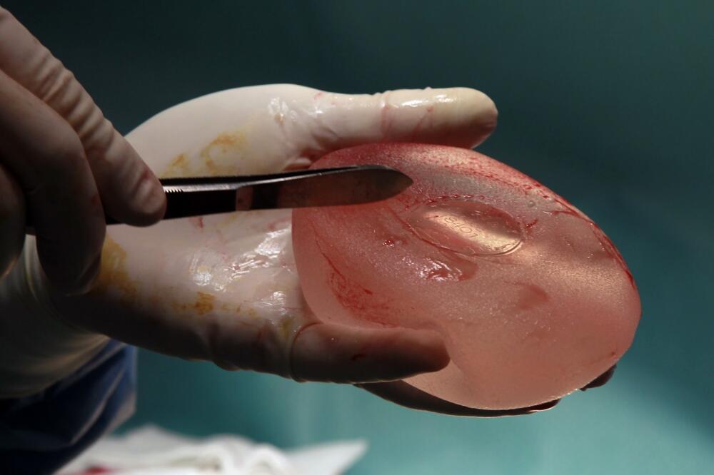 PIP, silikoni, Poly Implant Prosthese, Foto: Rojters
