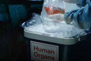 Turska: Istraga o prodaji organa