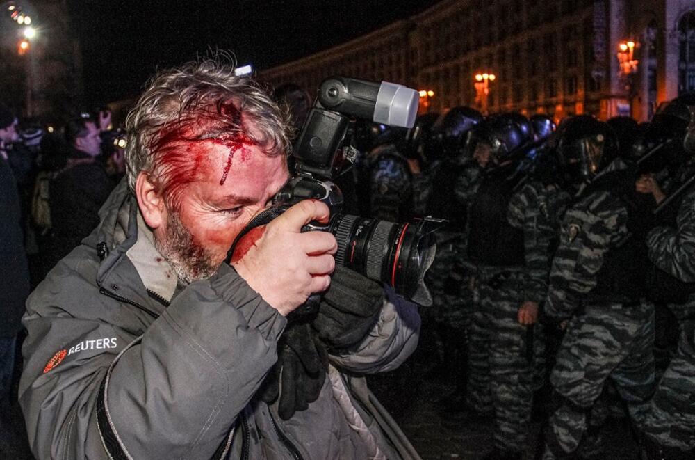 Kijev, protesti, povrijeđeni fotoreporter