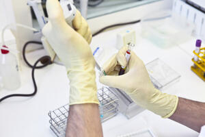 Crna Gora podržala Evropsku nedjelju HIV testiranja