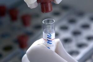 U Francuskoj uskoro kućni testovi na virus HIV-a