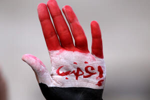 Amnesty International: Ukinuti kaznu odscijecanja šaka i stopala