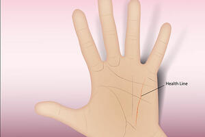 Japanski hirurg sujevjernima mijenja linije na dlanu