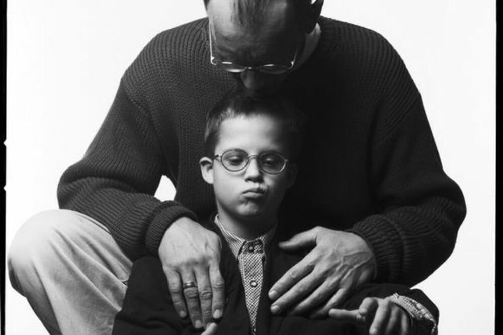 Daunov sindrom, Foto: Commons.wikimedia.org