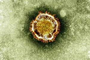 SZO: Novi virus sličan SARS-u, moguće opasan po čovječanstvo