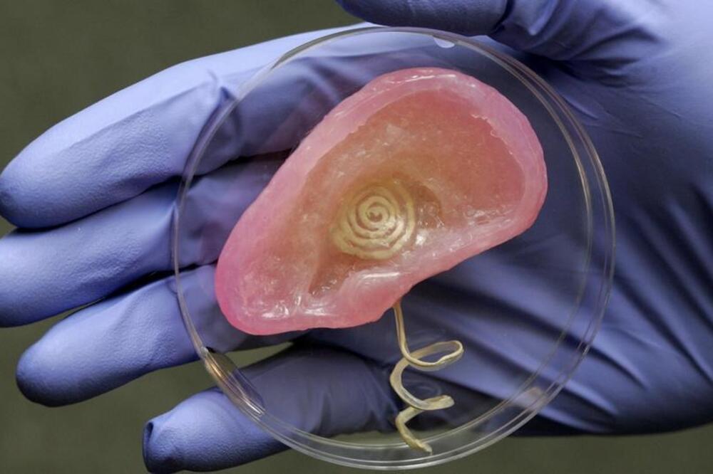 vještačko uvo, Foto: Mashable.com