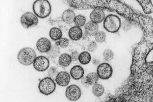 Drugi slučaj zaraze novim virusom u Francuskoj