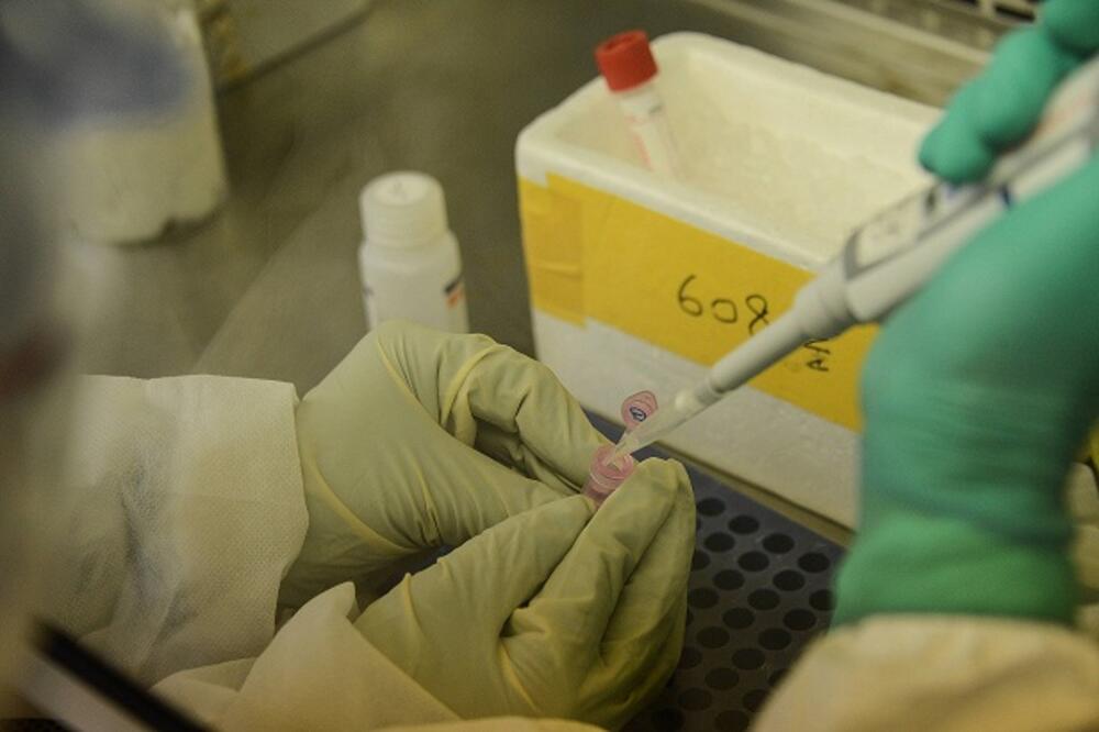 grip, laboratorija, Foto: Beta/AP