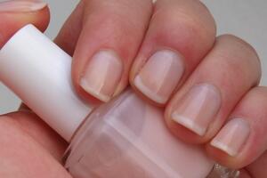 Šta nokti govore o našem zdravlju