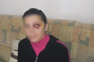 Centar za ženska prava traži od nadležnih da zaštite pretučenu...