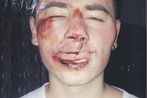 Žaklina Luković: Došla sam sa nožem, ali nisam vitlala