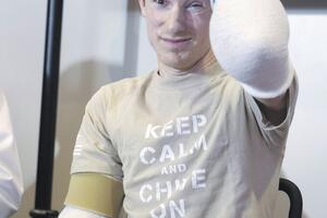 Američkom vojniku uspješno presađene obje ruke