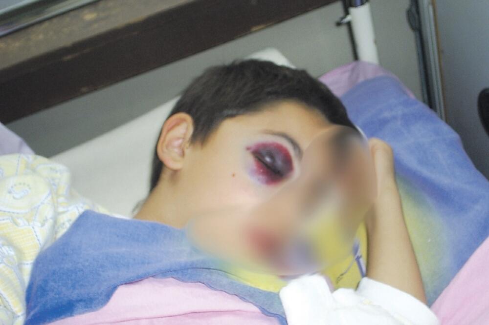 Povrijeđeni dječak Nedakusi, Foto: Beća Čoković