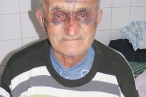 Policija još traga za napadačima na bjelopoljskog penzionera