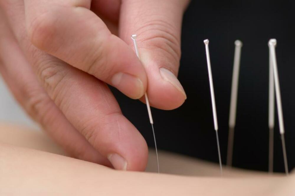 Akupunktura, Foto: Sciencedaily.com
