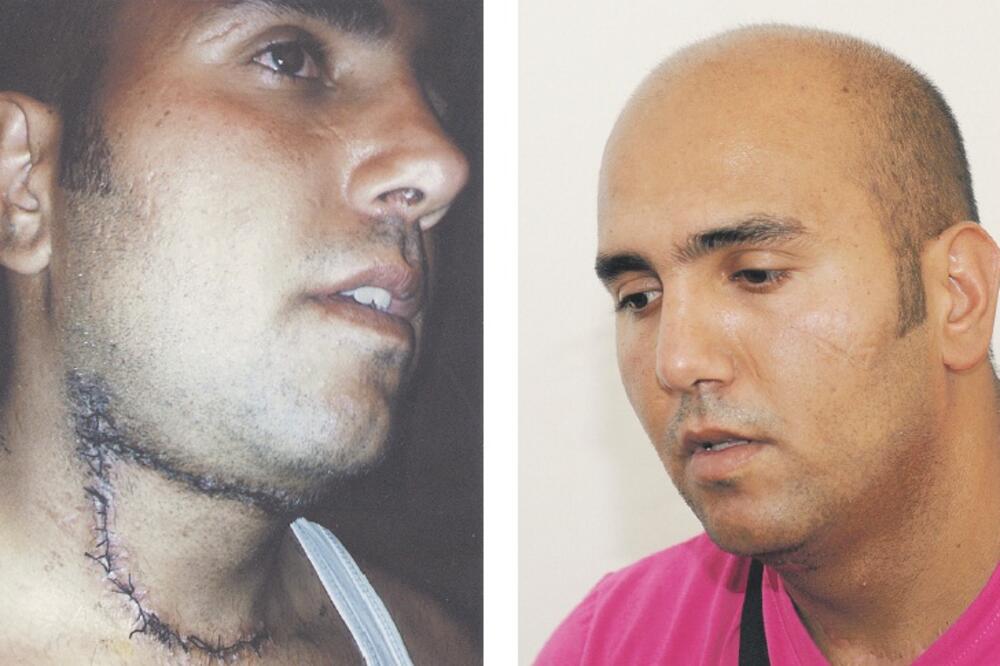 Elvir Drini, Foto: Savo Prelević