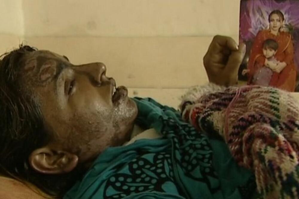 kiselina, Pakistan, Foto: BBC