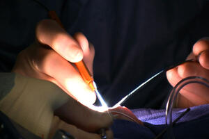 Uskoro operacije bez rezova