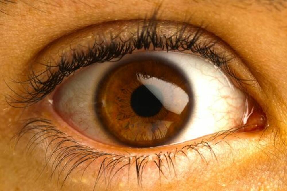 Crv iz oka, Foto: Rawstory.com