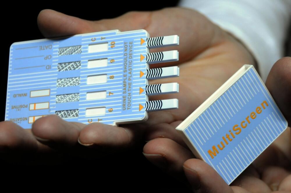 test droga narkotest, Foto: Luka Zeković