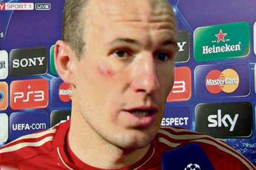 Roben, Foto: Bild.de