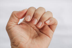 Zašto je opasno grickanje noktiju?