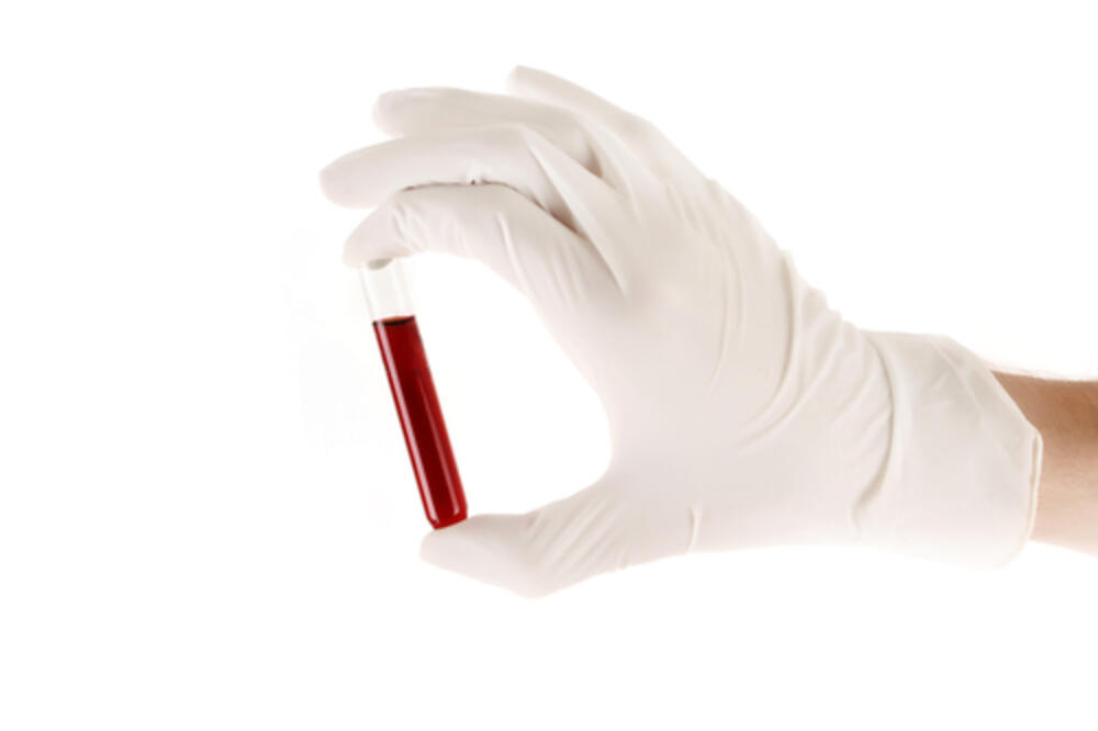 analiza krvi, Foto: Shutterstock.com
