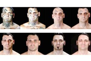 Brisanje mržnje: Amerikanac koji je uklonio tetovaže sa lica