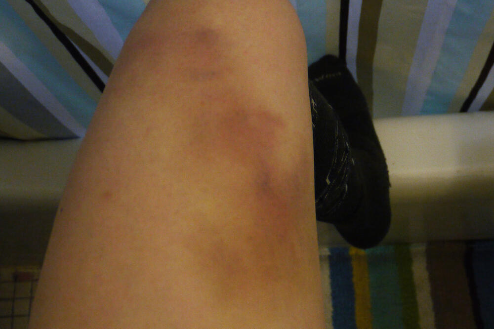 Ilustracija, Foto: Flickr