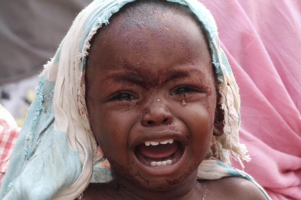 Somalija , glad, Foto: Rojters